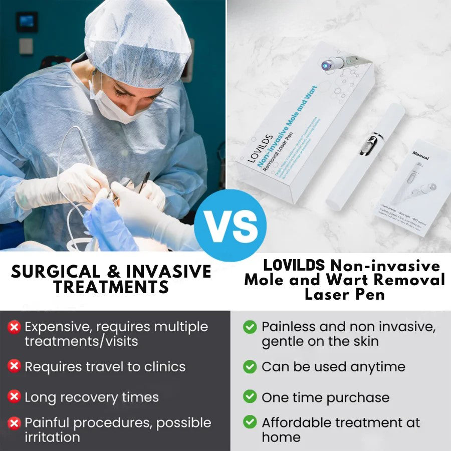 LOVILDS™ Non-Invasive Mole and Wart Removal Laser Pen