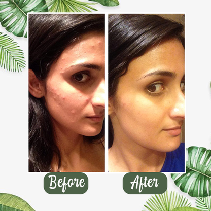 Grevéa™  Green Tea Deep Cleanse Mask Stick
