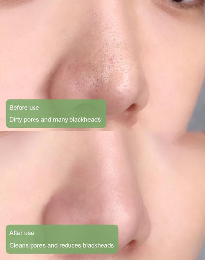 Grevéa™  Green Tea Deep Cleanse Mask Stick
